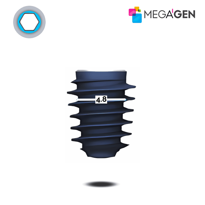 MegaGen AnyRidge Implantat | Kern: Ø 4,8 mm | Ø 7,0 mm | Länge: 13,0 mm