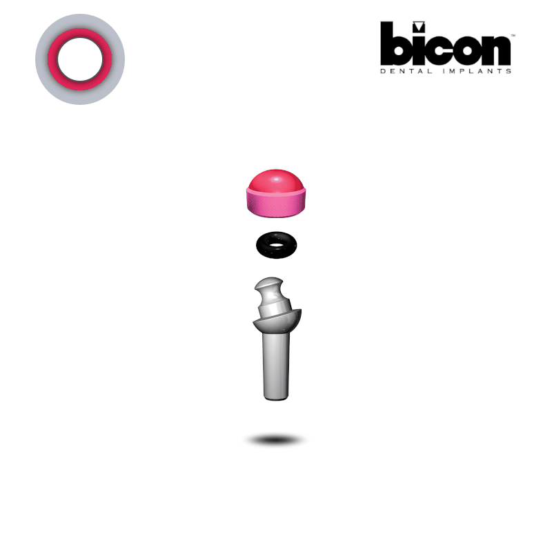 Bicon Kugelkopf Abutment 2,0 mm Schaft | 15° | Höhe: 4,0 mm