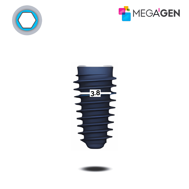 MegaGen AnyRidge Implantat | Kern: Ø 3,8 mm | Ø 4,5 mm | Länge: 15,0 mm