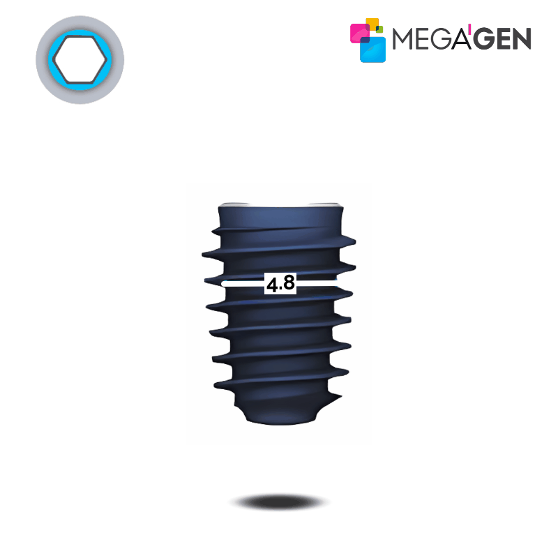 MegaGen AnyRidge Implantat | Kern: Ø 4,8 mm | Ø 6,5 mm | Länge: 13,0 mm