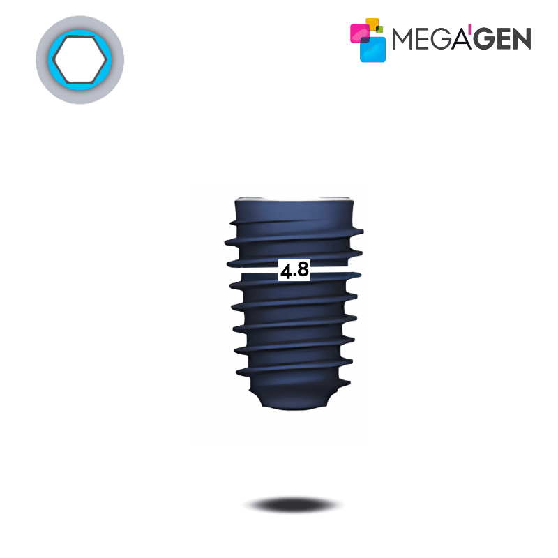 MegaGen AnyRidge Implantat | Kern: Ø 4,8 mm | Ø 5,5 mm | Länge: 15,0 mm MegaGen AnyRidge Implantat | Kern: Ø 4,8 mm | Ø 5,5 mm | Länge: 15,0 mm