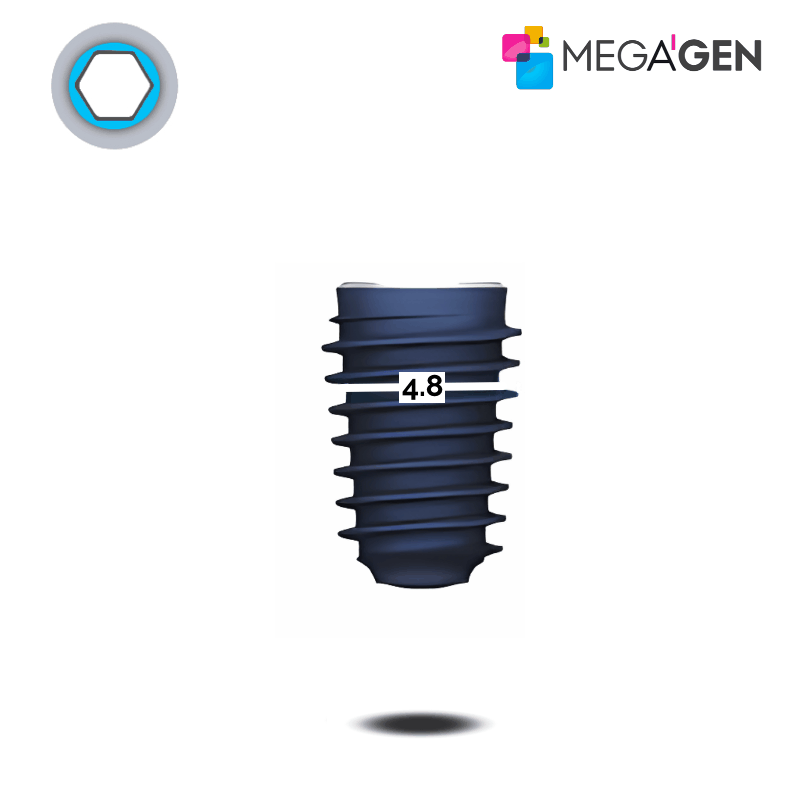 MegaGen AnyRidge Implantat | Kern: Ø 4,8 mm | Ø 5,5 mm | Länge: 15,0 mm