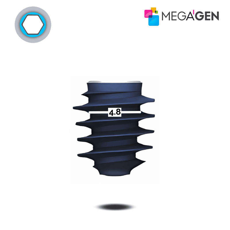 MegaGen AnyRidge Implantat | Kern: Ø 4,8 mm | Ø 8,0 mm | Länge: 13,0 mm