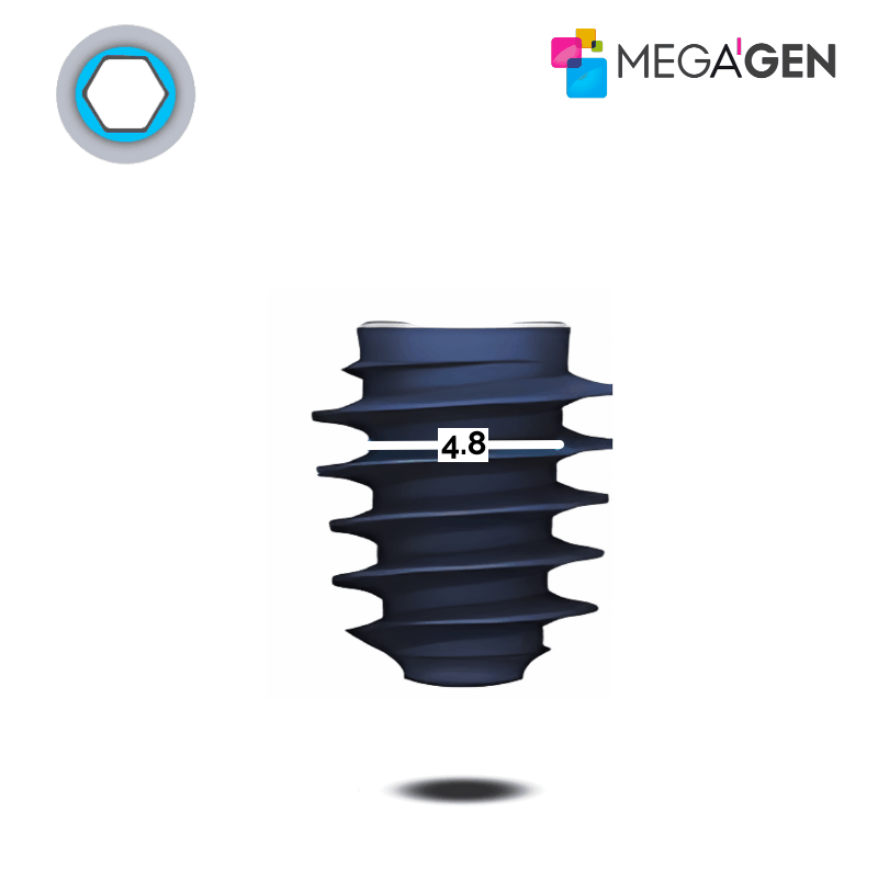 MegaGen AnyRidge Implantat | Kern: Ø 4,8 mm | Ø 7,5 mm | Länge: 13,0 mm