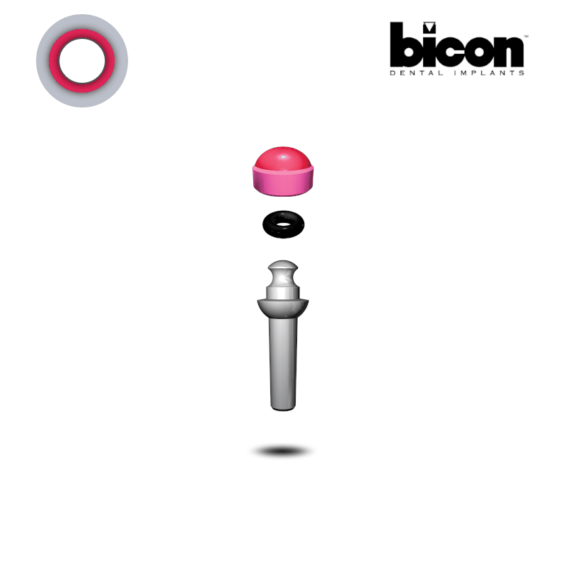 Bicon Kugelkopf Abutment 2,0 mm Schaft | 0° | Höhe: 6,0 mm